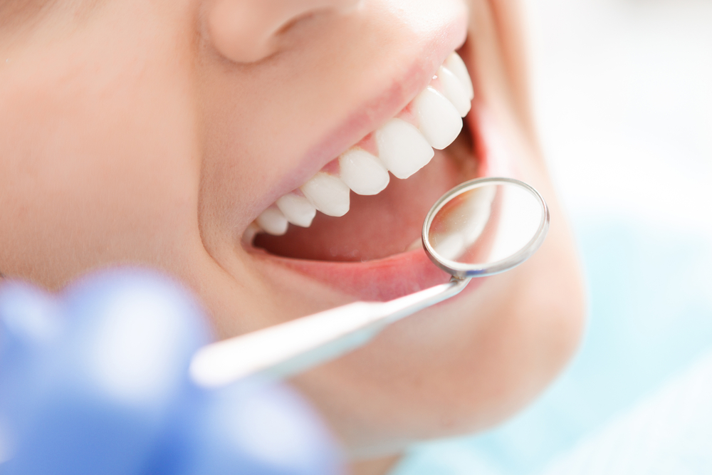 ODONTOLOGIA INVISALIGN