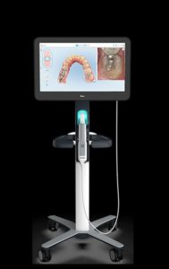 escáner intraoral itero, clínica dental nuevos ministerios