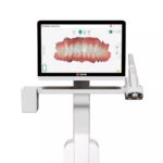 Escáner intraoral clínica dental madrid