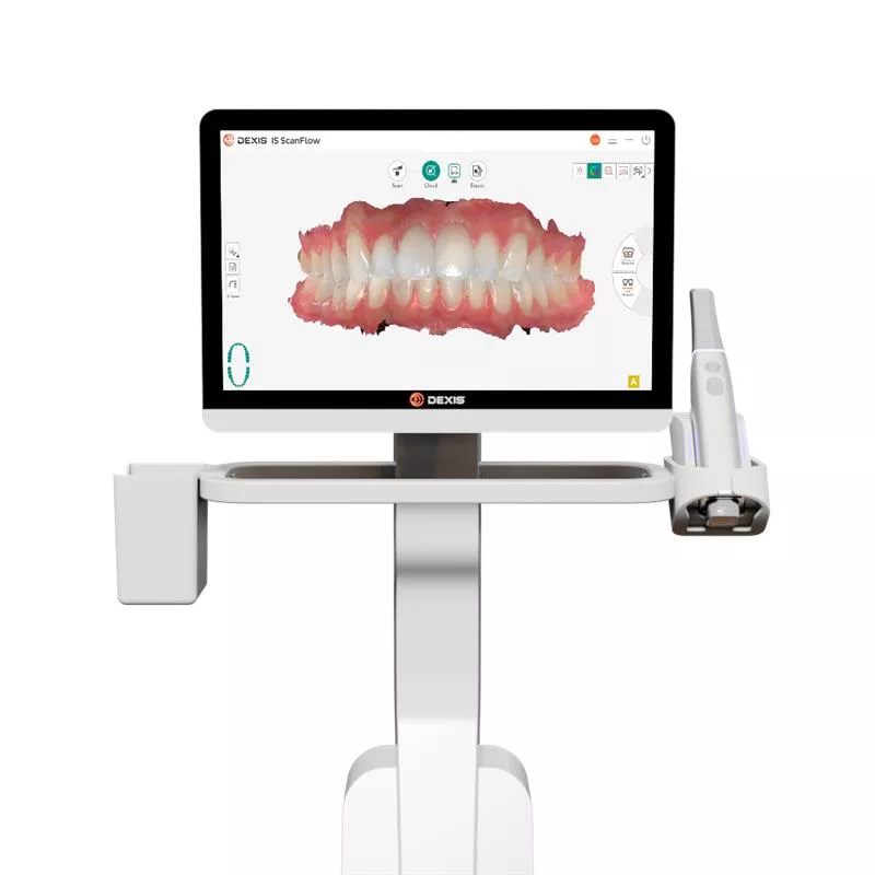 Escáner intraoral clínica dental madrid