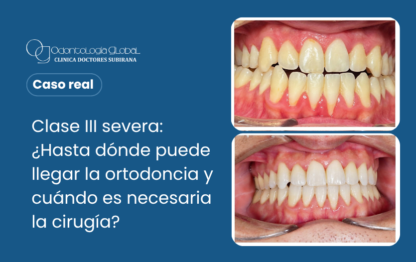 caso real blog 1