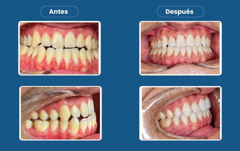 caso real blog 2